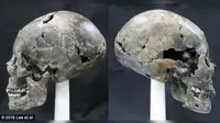 Tengkorak lonjong yang ditemukan peneliti di bekas Kerjaan Silla, Korea Selatan (Lee et al)