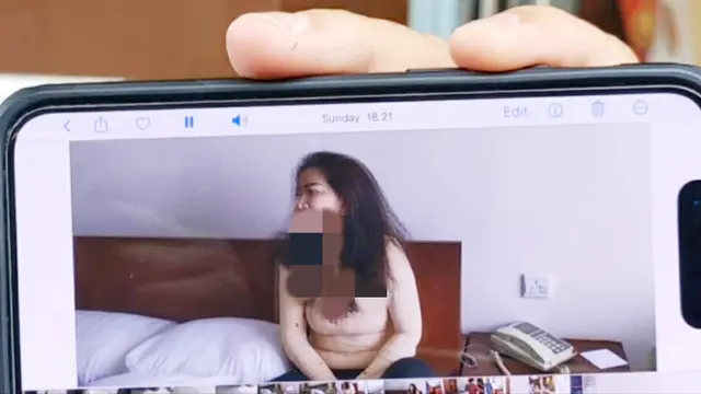 Pengacara menunjukkan foto Venna Melinda usai jadi korban KDRT suaminya. (Dian Kurniawan/Liputan6.com)