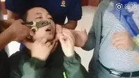 Hidung Bocah Ini Terjepit Gantungan Kunci, Penyelamatannya Bikin Heboh