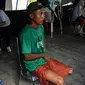 Seorang pria menunggu petugas melakukan pengukuran dan pencetakan kaki palsu di kantor Dinas Sosial Aceh, Senin (16/9/2019). Untuk tahun 2019 ini diberikan secara gratis sebanyak 100 kaki dan tangan palsu untuk para penyandang disabilitas di sejumlah kabupaten/kota. (CHAIDEER MAHYUDDIN / AFP)