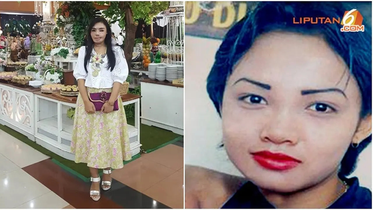 Potret Lisa 14 tahun yang lalu saat menjadi korban penyiraman air keras