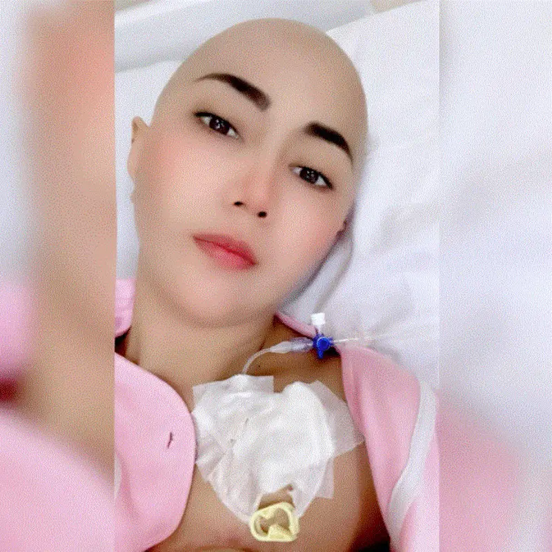 Aida Sakia jalani kemoterapi akibat kanker payudara