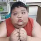 Rizki, bocah obesitas asal Palembang, sempat diterapi ahli gizi tetapi berhenti karena matanya memerah dan membengkak. (Liputan6.com/Nefri Inge)
