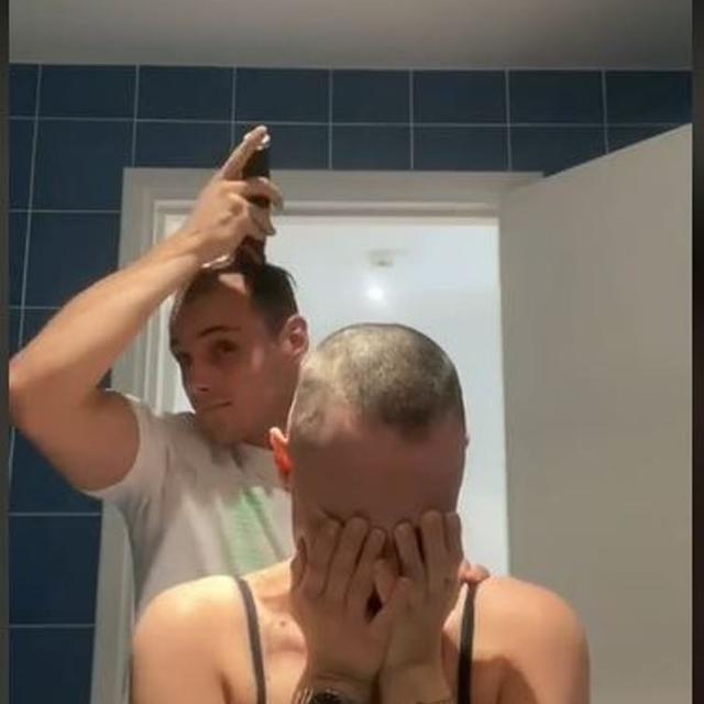 Pria Cukur Rambut Sampai Botak Demi Pacarnya yang Sakit Parah