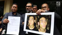 Aktor Jeremy Thomas menunjukkan foto luka yang dialami anaknya, Axel Matthew, di Divisi Propam Mabes Polri, Jakarta, Senin (17/7). Jeremy Thomas melaporkan orang yang diduga oknum polisi atas kekerasan yang dialami putranya. (Liputan6.com/Herman Zakharia)