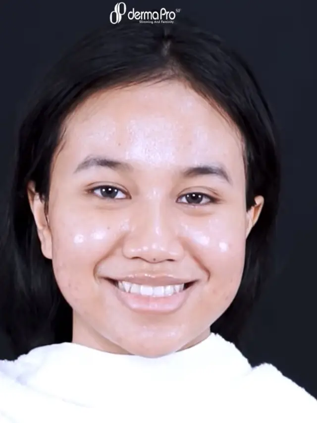 Makin Glow Up, Ini 6 Momen Mayang Perawatan Wajah Rp 80 Juta