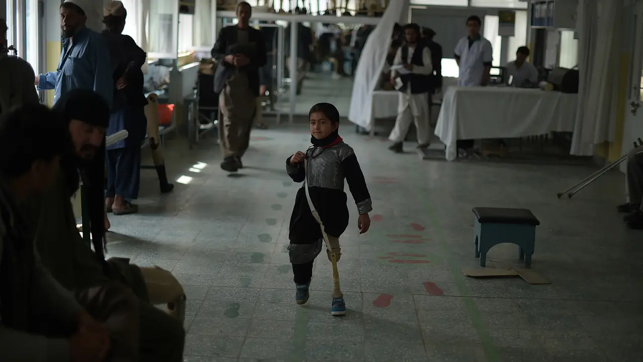 20160404-Kisah Pilu Para Korban Perang Afghanistan-Kabul