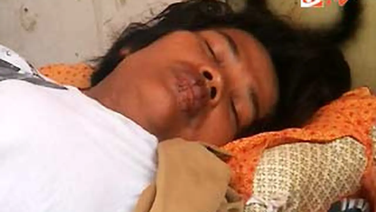 110213terk6_jahit-mulut.jpg