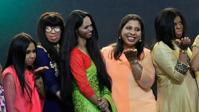 Hari Perempuan Internasional, Korban Siraman Air Keras Jadi Model di India