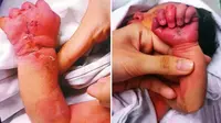 Seorang perawat terkejut melihat seorang ibu sedang menggigit lengan anaknya di RS.