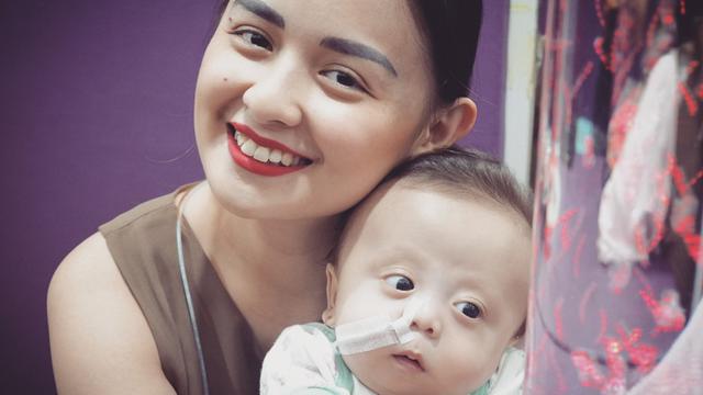 Harga Obat Penyakit Langka Anak Joanna Alexandra Mencapai Rp 3 Miliar Showbiz Liputan6 Com