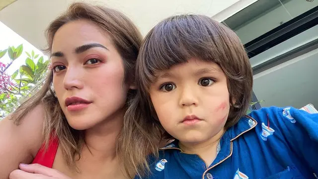 6 Potret Terbaru Jessica Iskandar, Leher Bengkak Akibat Sakit Tiroid