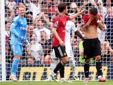 Pemain Manchester United, Bruno Fernandes, tak mampu menutupi kekecewaan setelah gagal mencetak gol melalui titik putih saat melawan Fulham dalam laga pekan ke-2 Premier League 2025/2026 di Craven Cottage, Minggu (24/8/2025) malam WIB. (Adam Davy/PA via AP)