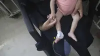 Rombongan Pertama Anak Gaza Segera Diterbangkan ke Inggris untuk Perawatan Medis