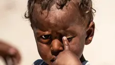 Seorang anak terlantar Suriah menggaruk matanya di kamp Washukanni untuk pengungsi internal selama bulan suci Ramadan di provinsi Hasakeh di timur laut Suriah, (10/5/2020). (AFP/Delil Souleiman)