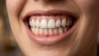 Tooth Gem Bikin Gigi Berkilau tapi Kenali Juga Risiko di Baliknya