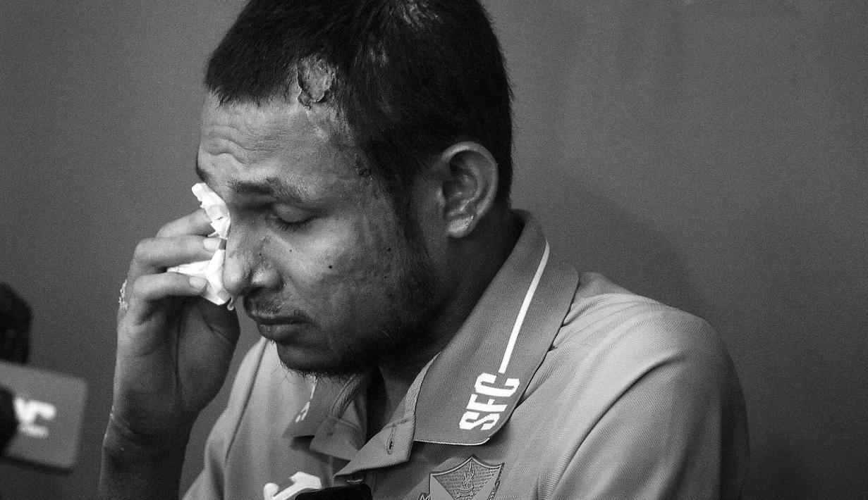 Pemain Malaysia, Faisal Halim menyeka matanya saat jumpa pers pemusatan latihan Selangor FC di Padang SUK Shah Alam, Kamis (13/6/2024). Terlihat luka bakar di sejumlah bagian tubuhnya akibat insiden penyiraman air keras oleh orang yang tak dikenal pada 5 Mei 2024. (AFP/Arif Kartono)