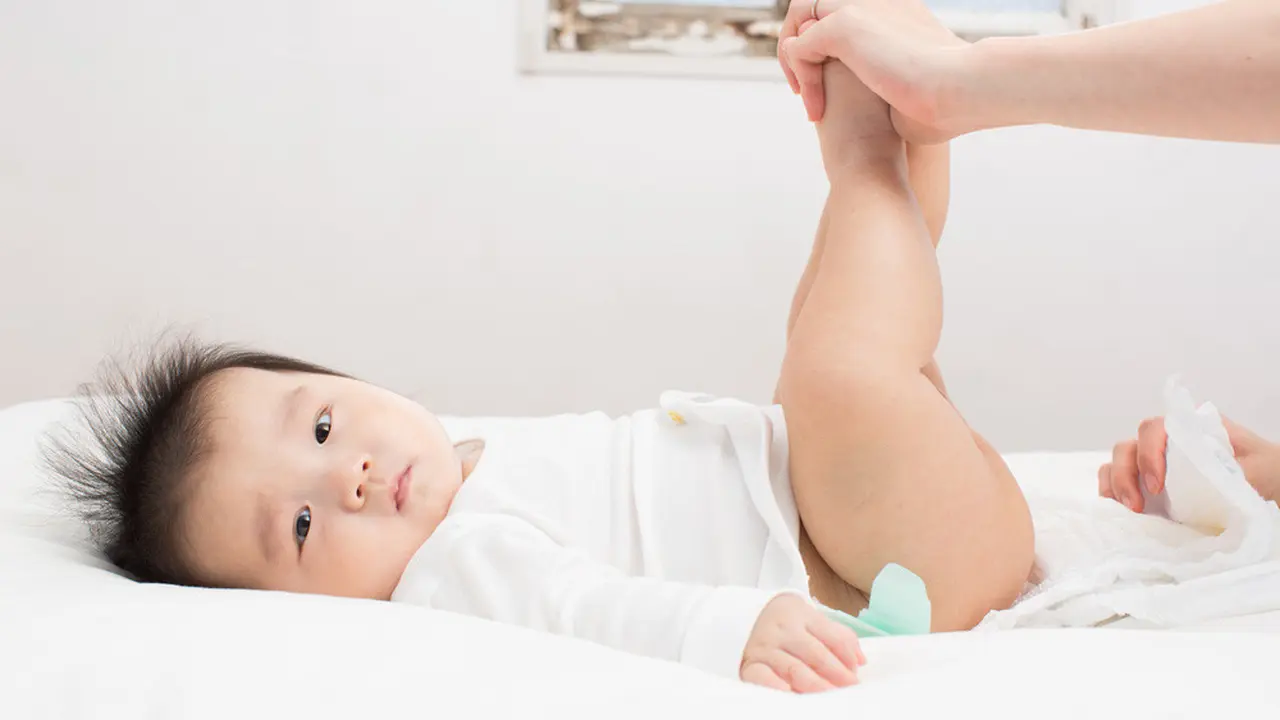 Lakukan Ini Saat Bayi Alami Ruam Popok (Ucchie79/Shutterstock)