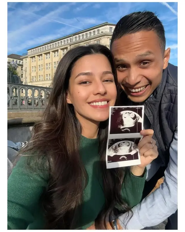 6 Potret Susan Sameh umumkan hamil anak pertama, pamer hasil USG di Jerman