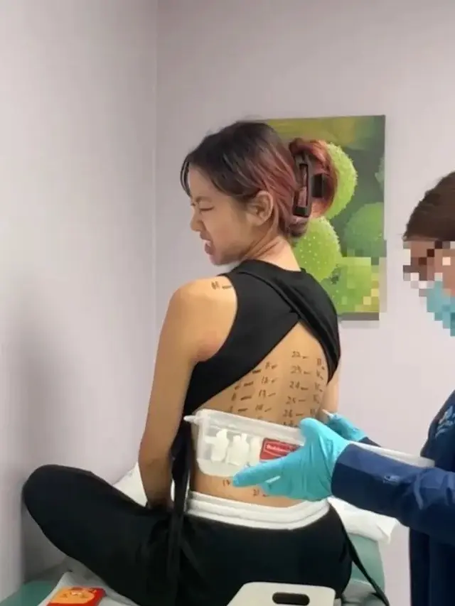 Kisah Wanita dengan 37 Alergi