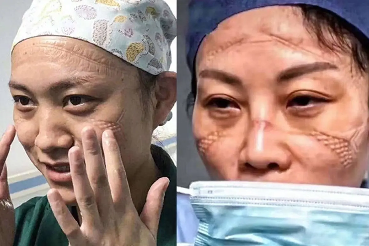4 Kisah Perjuangan Dokter dan Perawat di Wuhan Rawat Pasien Virus Corona, Bikin Haru