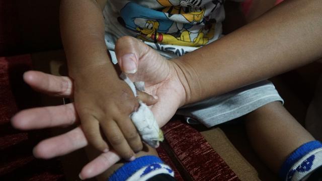 Bocah digigit ikan aligator