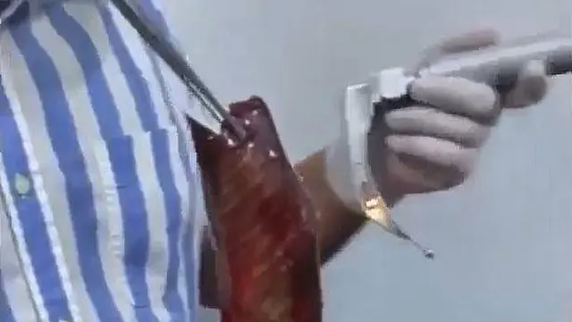 Kisah Pria Nyaris Tewas Tersedak Ikan Hidup Saat Memancing