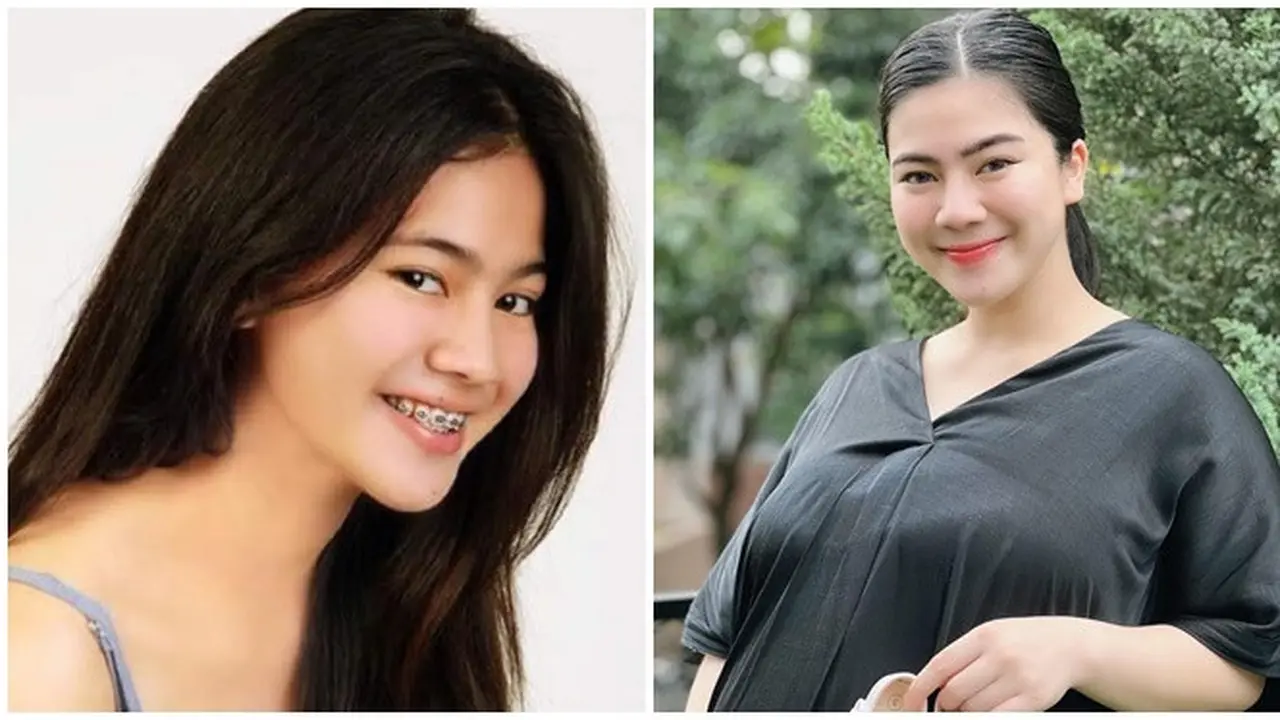 6 Potret Masa Remaja Felicya Angelista, Kini Genap 27 Tahun