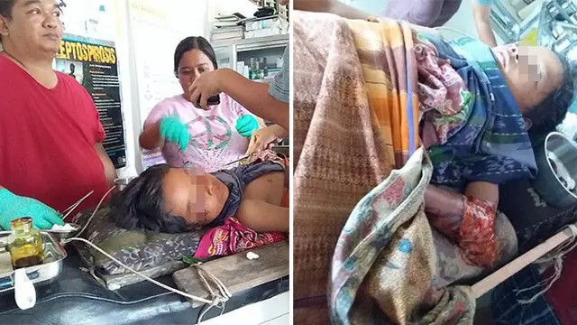 Demi Selamatkan Anak, Seorang Ayah Nekat Bertarung Dengan Buaya