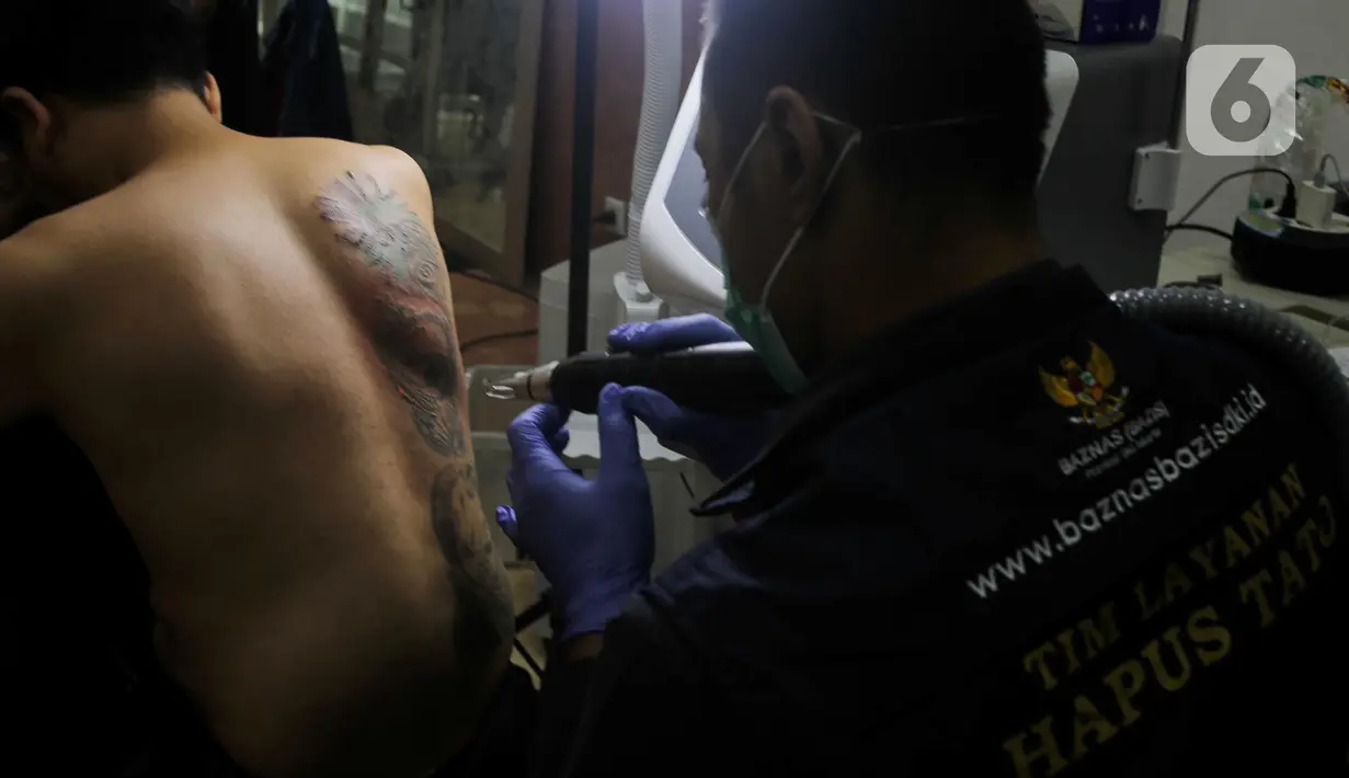Petugas menghapus tato peserta menggunakan sinar laser di Balai Kota DKI Jakarta, Selasa (11/3/2025). (LIputan6.com/Herman Zakharia)