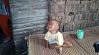Balita di Serang, Banten, gemar memakan batu bata gara-gara tak ada makanan di rumah (Liputan6.com/Yandhi Deslatama)