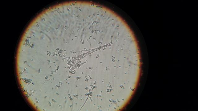 Jenis-Jenis Bakteri dan Ciri-cirinya yang Perlu Diketahui - Ragam Bola.com