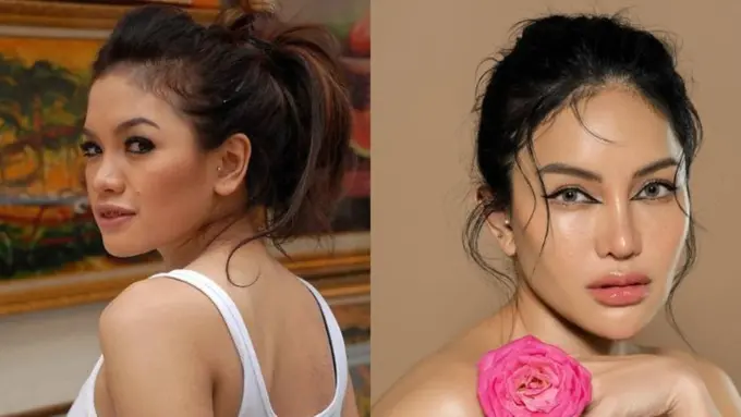 Habiskan Rp1M untuk Percantik Diri, Ini Potret Nikita Mirzani Before dan After Perawatan Wajah