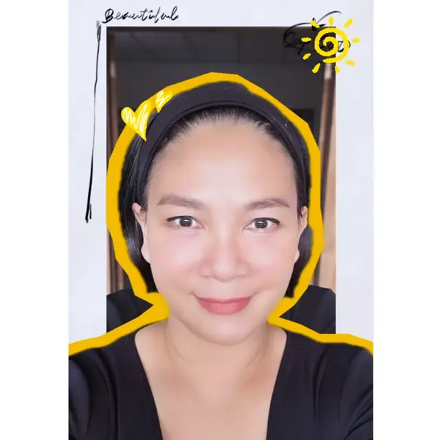 6 Potret Dian Nitami Pasca 3 Minggu Oplas Face Lifting, Kerutan Wajah Berkurang
