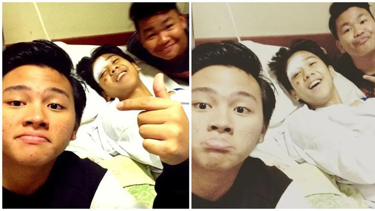 Kondisi Iqbaal CJR kecelakaan