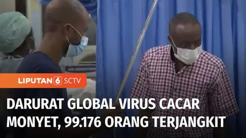 VIDEO: WHO Sebut Monkeypox Sudah Jadi Darurat Global, 88 Orang di Indonesia Terjangkit