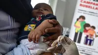 Suspek Campak Masih Tinggi hingga Awal 2026, Dinkes Jabar Ingatkan Orangtua untuk Imunisasi Anak