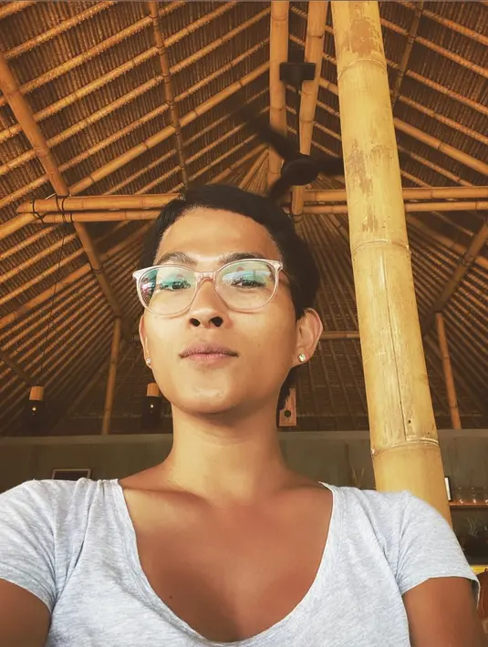 Saat itu, Oscar mengaku dirinya ditemani sang ibu. Ketika pertama kali membuka mata setelah dibius total, sosok pertama yang dilihat adalah ibyunya. (Foto: instagram.com/oscarlawalata)