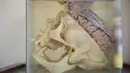 Salah satu otak manusia yang diawetkan di Museum Neuropatologi, di Rumah Sakit Santo Toribio de Mogrovejo, Lima, Peru (16/11). Neuroptologi adalah adalah sebuah subspesialisasi patologi yang berhubungan dengan penyakit otak. (AFP Photo/Ernesto Benavides)