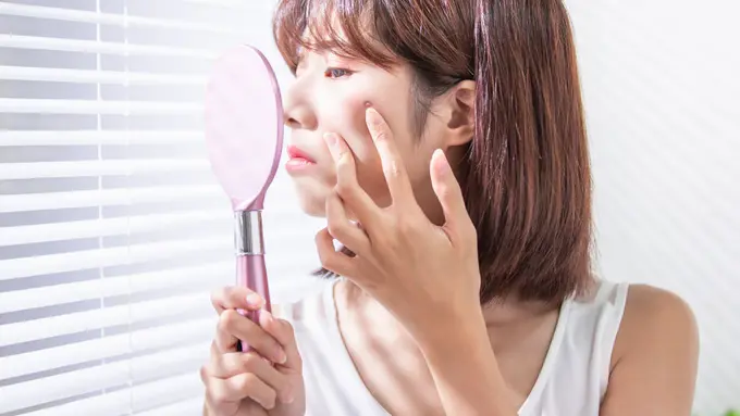 Flek Hitam Muncul Pada Wajahmu? Ketahui Berbagai Penyebabnya Sekarang Juga
