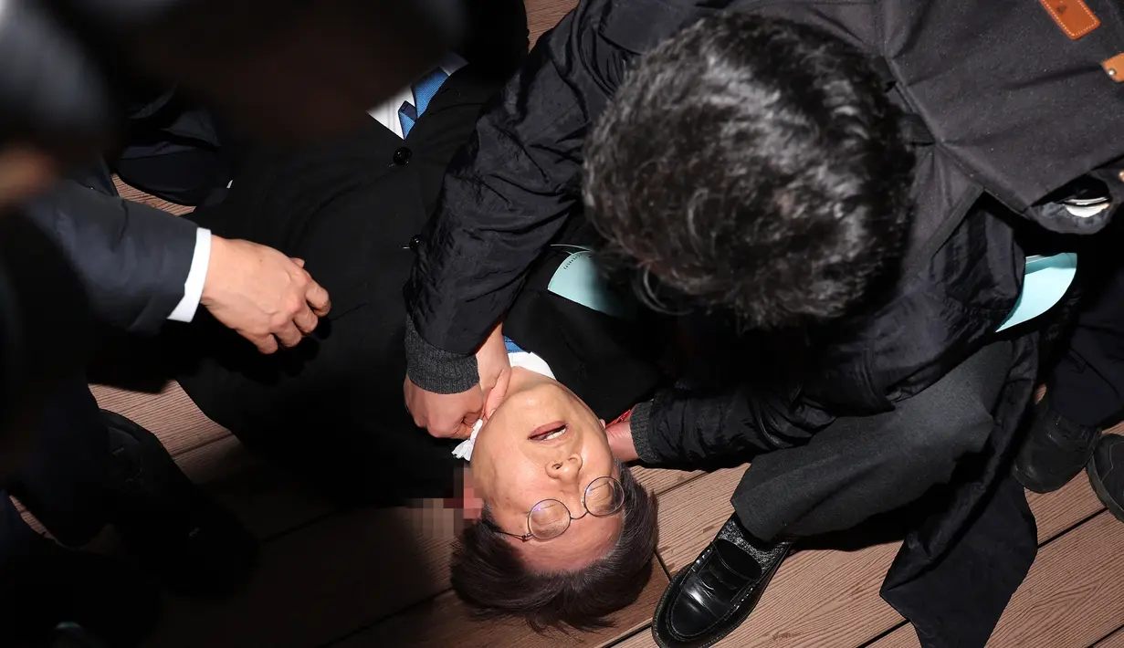 Lee ditikam di bagian leher hingga mengalami luka-luka, dan pelaku penikaman telah ditangkap di lokasi. (YONHAP / AFP)