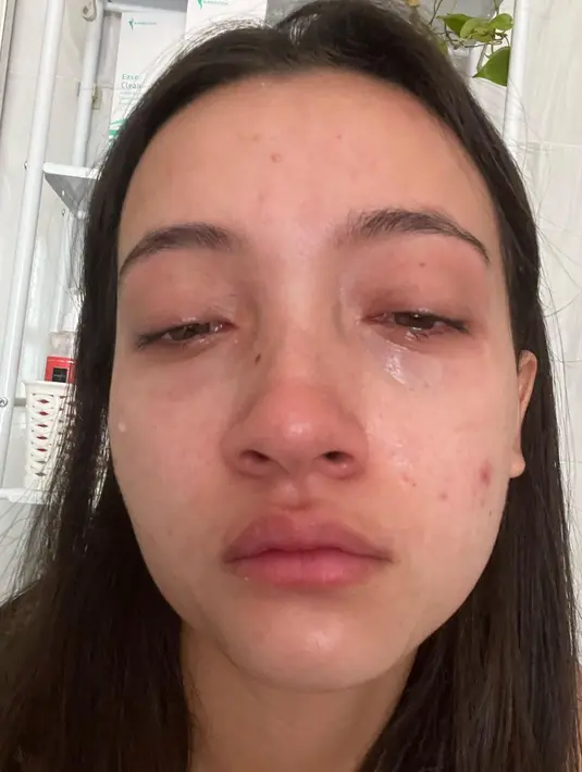 Saking parahnya, ia sampai insecure dan kehilangan percaya diri. Ada momen ia nangis tak ingin bertemu orang lain. [Instagram @megandomani1410]