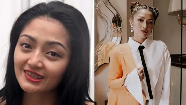 7 Potret Lawas Pedangdut Cantik Sebelum dan Sesudah Terkenal Ini Bikin Pangling