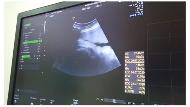 8 Momen Cut Meyriska dan Roger Danuarta Cek Kehamilan, Penasaran Wajah Anak