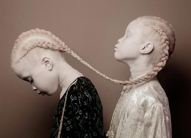 Lara dan Mara buktikan bahwa gadis albino juga cantik | Photo: Copyright boredpanda.com