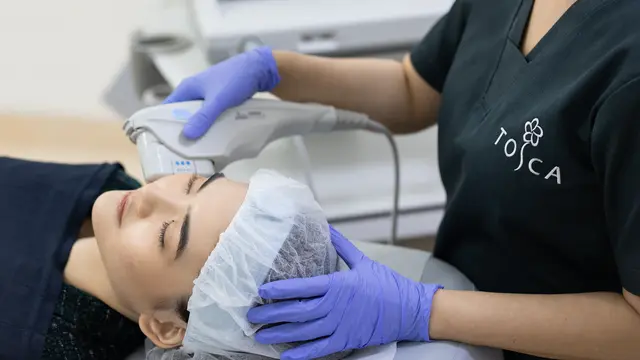 Ilustrasi Mengencangkan Wajah dengan Teknologi Ultherapy Prime. dok. TOSCA Aesthetic Clinic