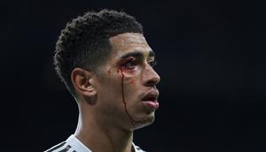 Darah mengalir di wajah gelandang Real Madrid, Jude Bellingham, setelah imengalami cedera dalam pertandingan Liga Spanyol melawan Celta Vigo di Stadion Santiago Bernabeu, Senin (8/12/2025) dini hari WIB. (Thomas Coex/ AFP)