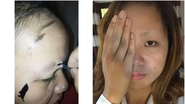 [Bintang] Salah Pakai Masker, Cewek Ini Nangis Kejer karena Kesakitan dan Alisnya Hilang