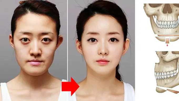 Foto: copyright kpsurgery.co
