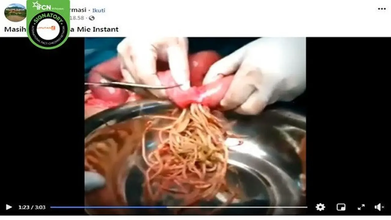 Gambar Tangkapan Layar Video Operasi Bedah Usus